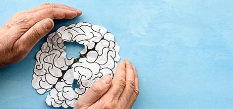 Old person&#39;s hands cradling paper image of brain with burn holes